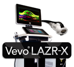フォトアコースティック・イメージング Vevo<sup>®</sup> F2 LAZR-X