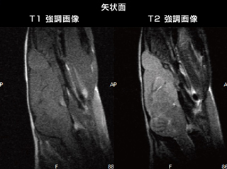 矢状面