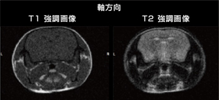 矢状面