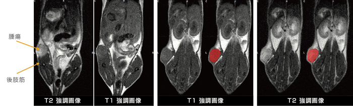 皮下子宮頸部腫瘍