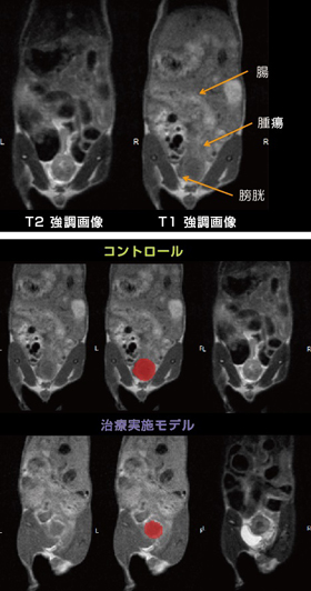 同所性患者由来子宮頸部腫瘍