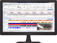 脳波・睡眠解析ソフトウェア