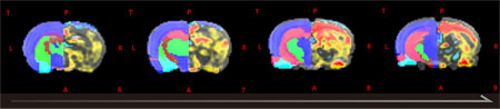 刺激投与前後のfMRI Voxelベースの増減率、経時的変化