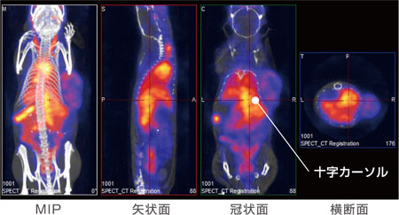 スライス表示