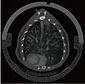 マウス肺のゲート制御画像