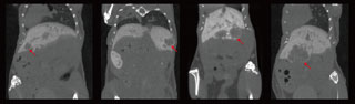マウス肝臓の造影CT ・・原発性肝細胞癌(HCC)マウスモデルにおける肝臓の腫瘍を検出