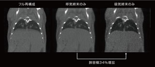 マウス肺のゲート制御画像
