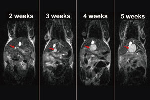 低磁場1テスラ 高性能コンパクトMRI