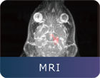 MRI